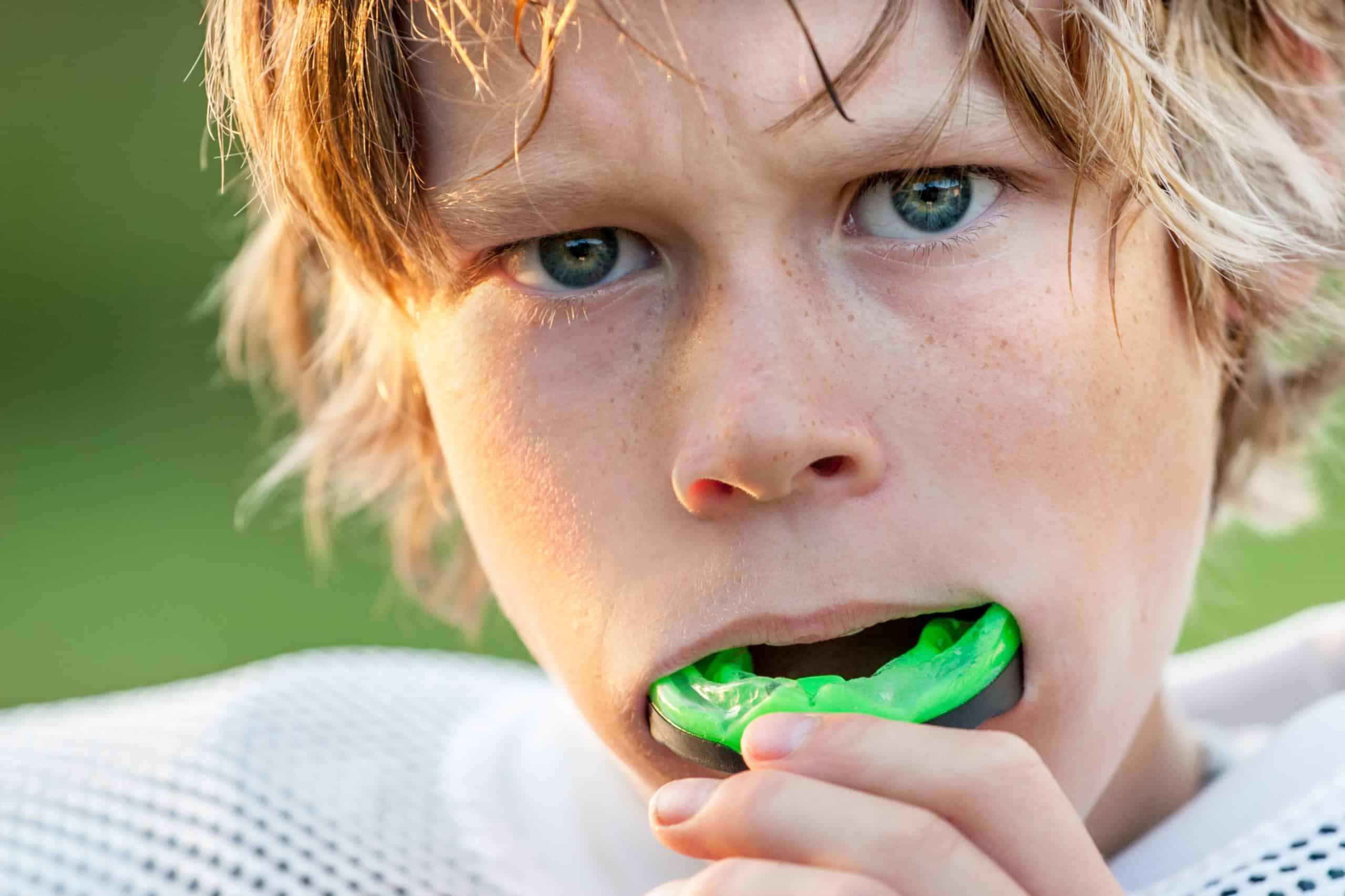 Why are Mouth Guards so important?